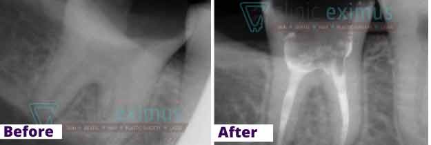 Before-rct-opt