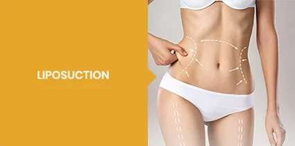 Liposuction