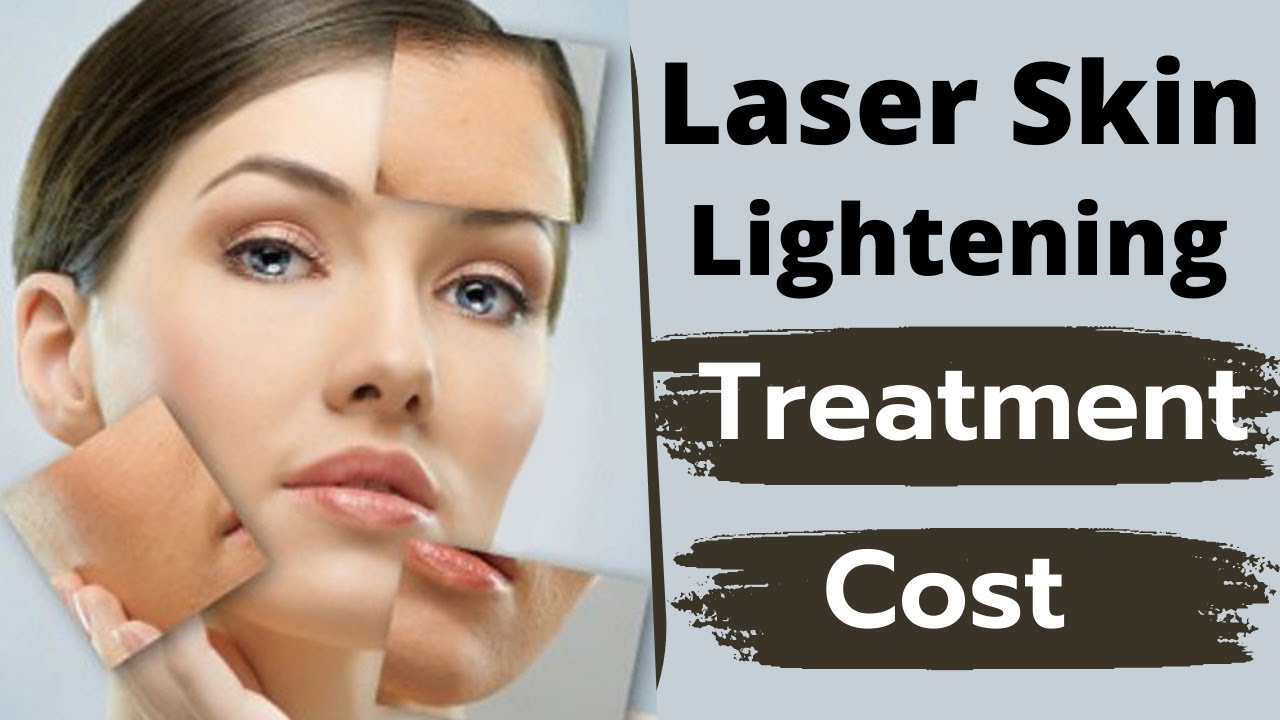 Laser Skin Lightening Whitening Treatment And Cost