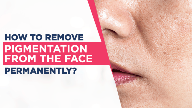 Remove pigmentation