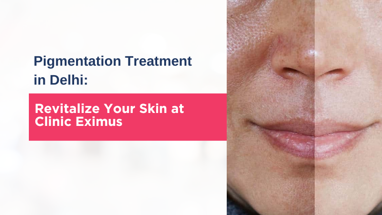 Pigmentation treatment in delhi