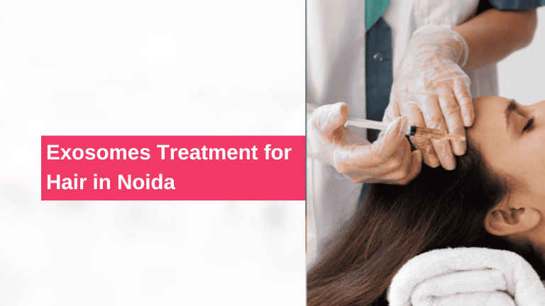 Best Exosomes Treatment for Hair in Noida