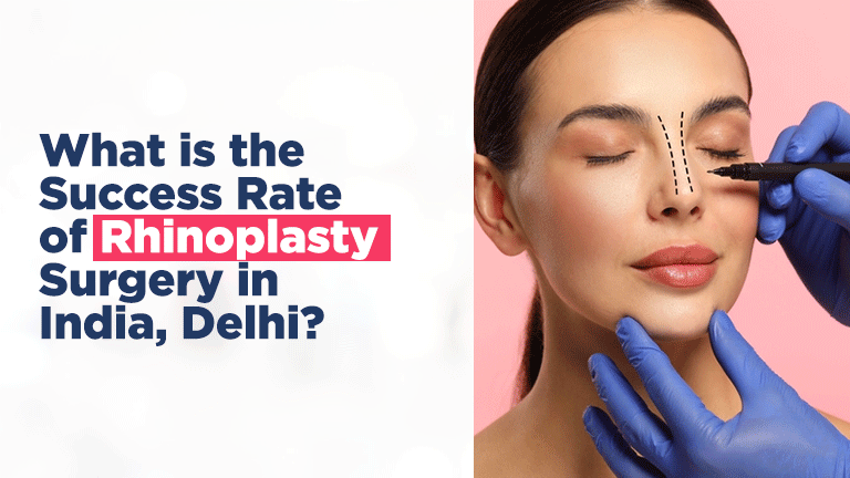 rhinoplasty surgery