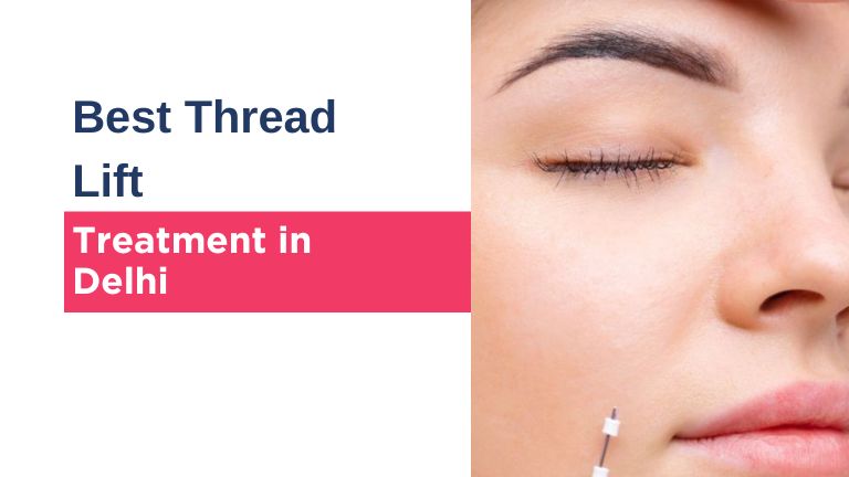 Thread Lift Treatment in Delhi