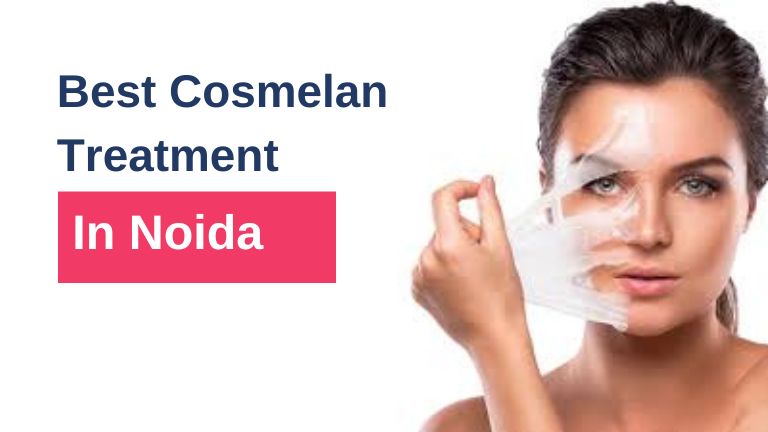 Best Cosmelan Treatment in Noida